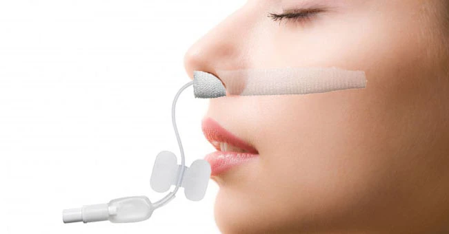epistaxis2.jpg